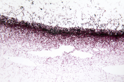 Candida Albicans Yeast testing